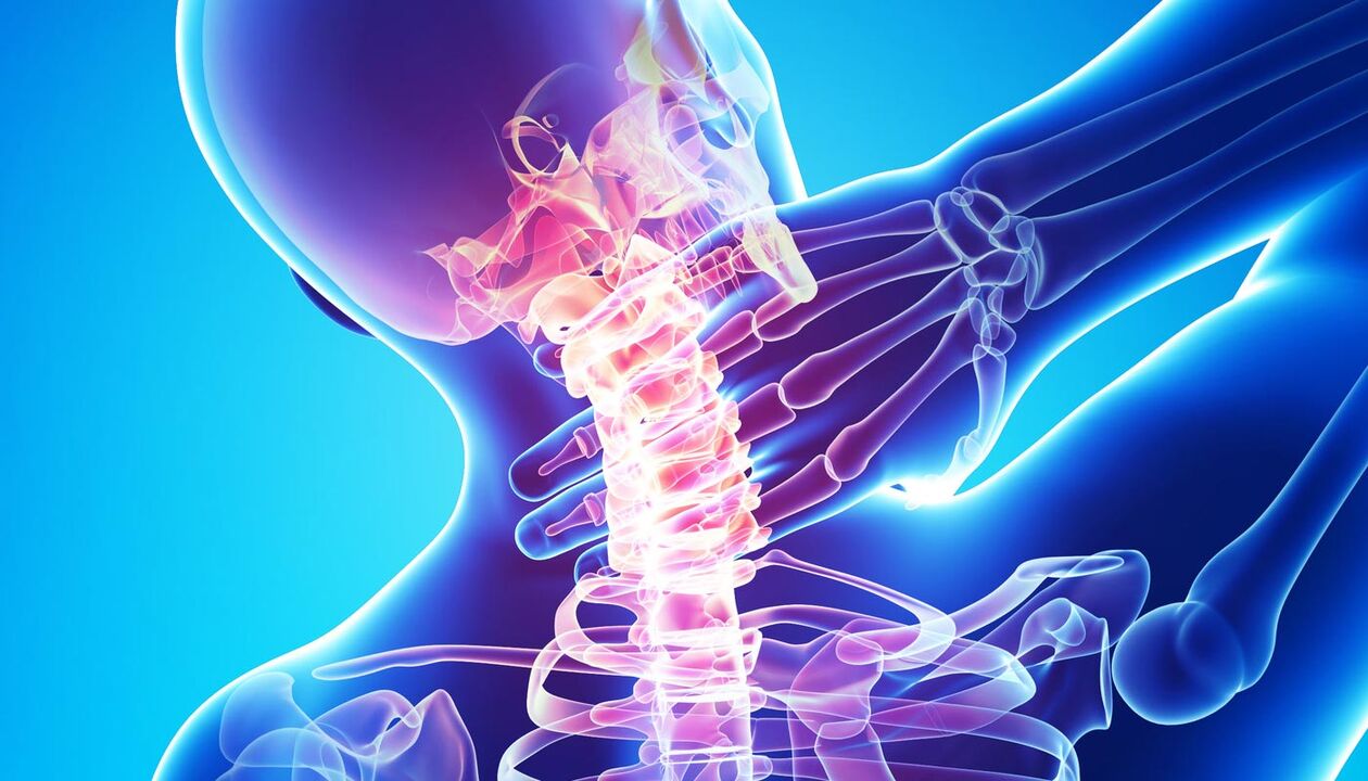 Osteokondroz nedeniyle boyun ağrısı