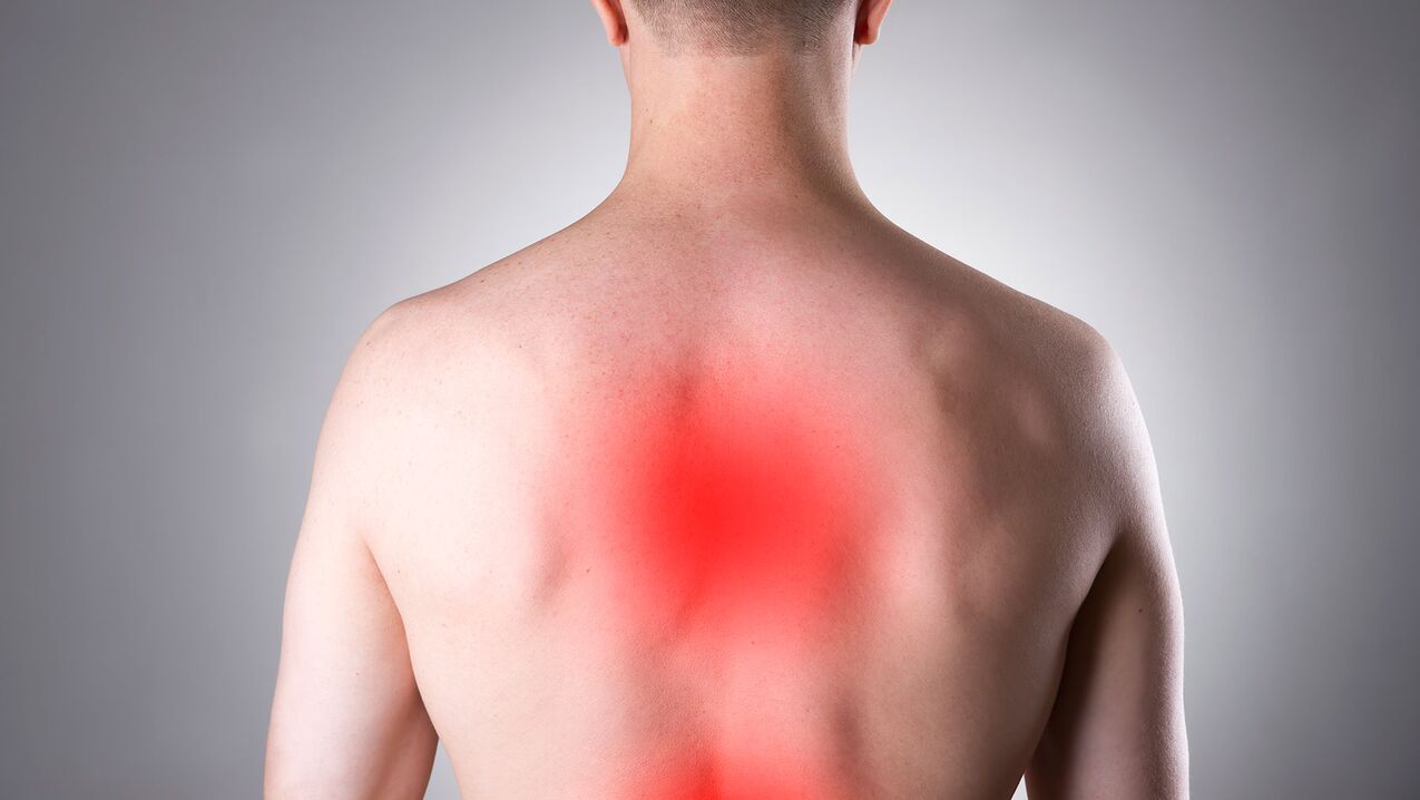 Osteokondroz nedeniyle sırt ağrısı