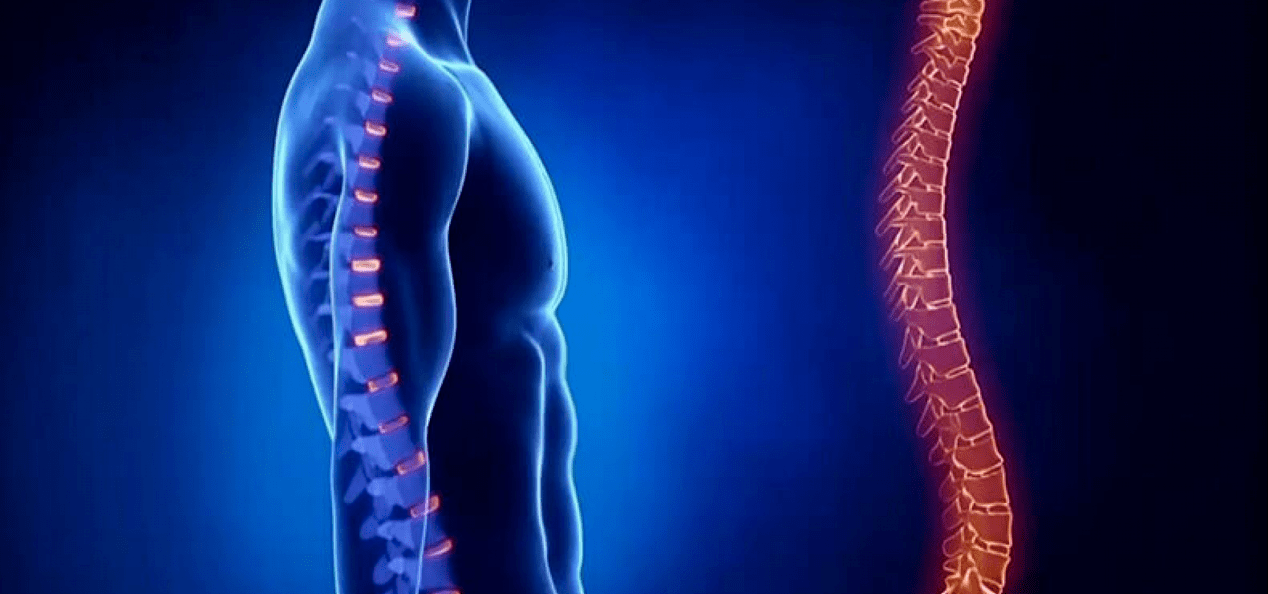 Osteokondroza bağlı omurga lezyonları